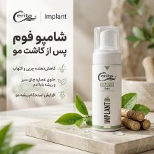 شامپو فوم پس از کاشت مو سریتا مدل Implant حجم 150 میلی‌لیتر، کاهش‌دهنده چربی، حاوی عصاره چای سبز و ریشه بابا آدم، افزایش استحکام ریشه مو و رفع التهاب پوست سر